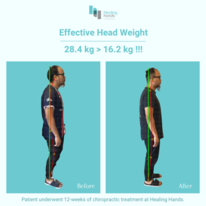 Healing Hands Chiropractic Singapore Before and After Comparison Picture 2