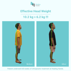 Healing Hands Chiropractic Singapore Before and After Comparison Picture 3