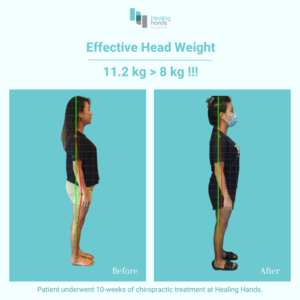 Healing Hands Chiropractic Singapore Before and After Comparison Picture 4