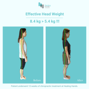 Healing Hands Chiropractic Singapore Before and After Comparison Picture 5