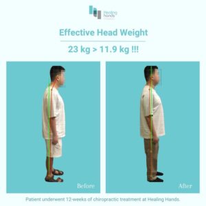 Healing Hands Chiropractic Singapore Before and After Comparison Picture 6