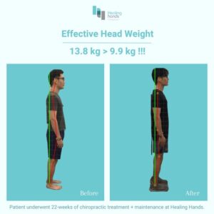 Healing Hands Chiropractic Singapore Before and After Comparison Picture 7