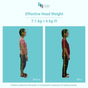 Healing Hands Chiropractic Singapore Before and After Comparison Picture 8
